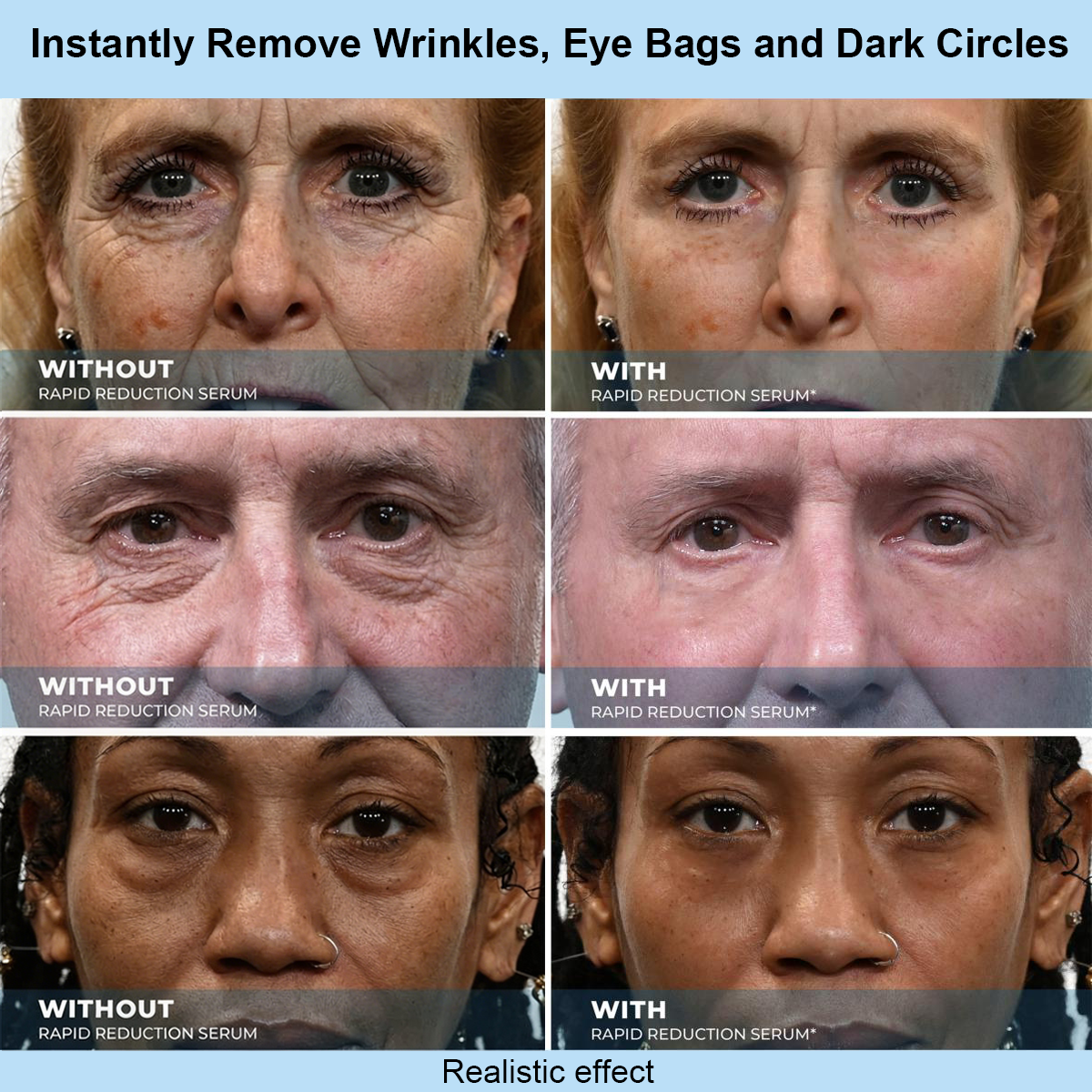 NORMALTA® Instant Face Temporary Tightener – Instant visible results in 30 seconds
