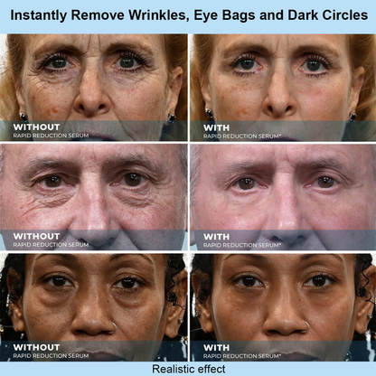 NORMALTA® Instant Face Temporary Tightener – Instant visible results in 30 seconds