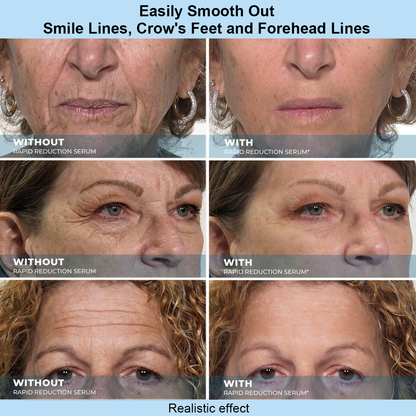 NORMALTA® Instant Face Temporary Tightener – Instant visible results in 30 seconds